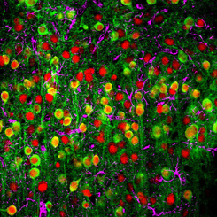 A two-photon microscopy image showing a calcium sensor (green), the nuclei of neurons (red) and supporting cells called astrocytes (magenta). Credit: John Issa/Johns Hopkins Medicine